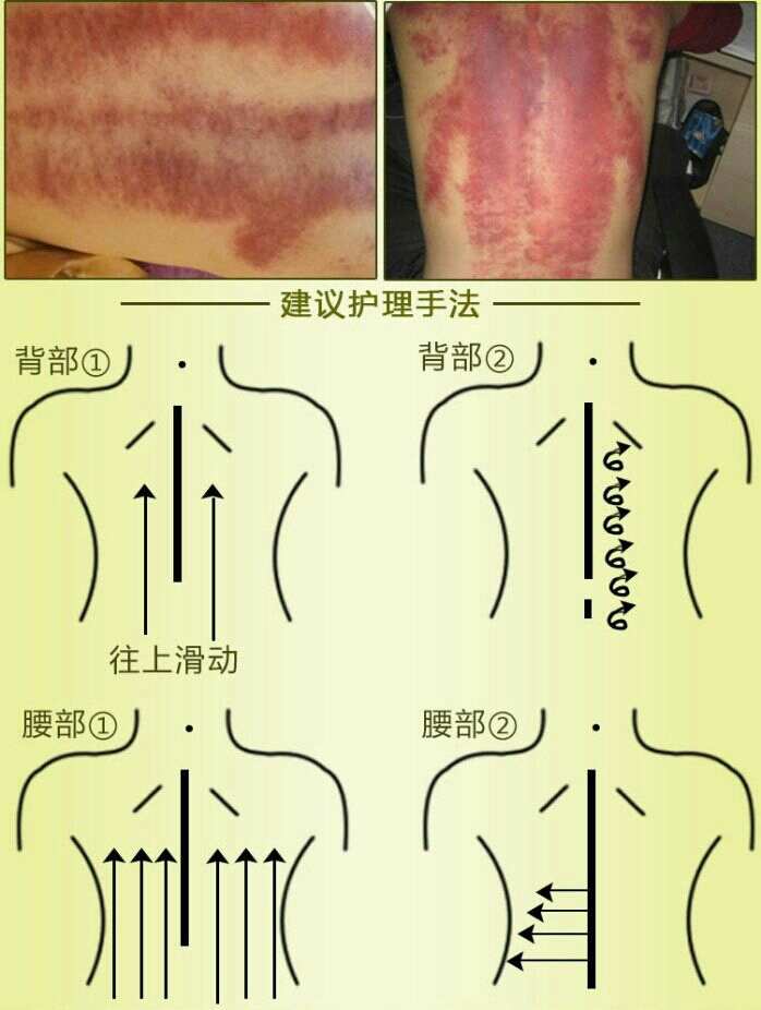 手机刮痧游戏_刮痧出自哪款游戏_刮痧游戏用语