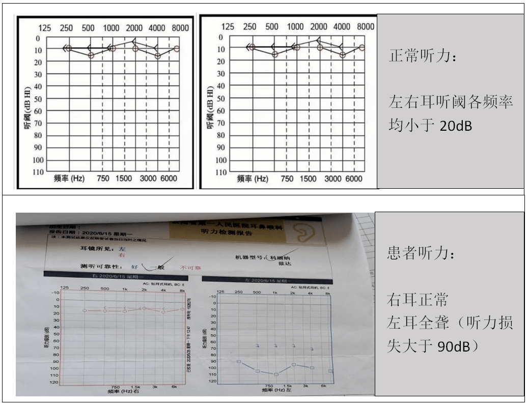 葱聋的寓意是什么_葱聋_妄想山海葱聋